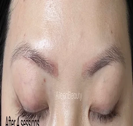 Warm saturated brow tattoo — after non-laser removal, real client