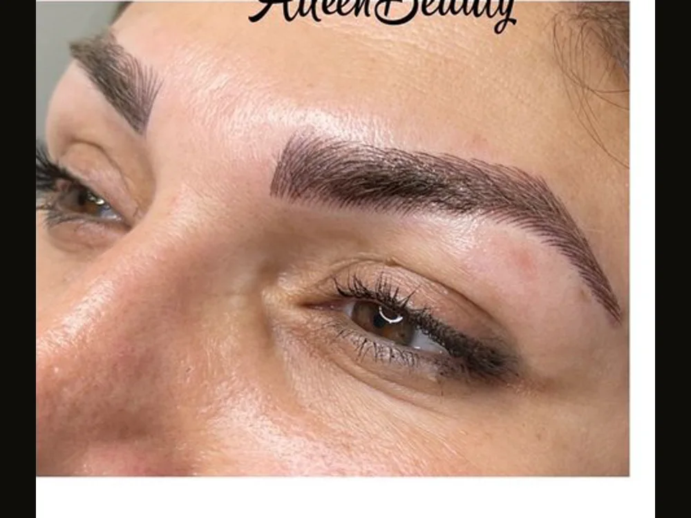 Mis-shaped cosmetic tattoo — after non-laser removal, real client