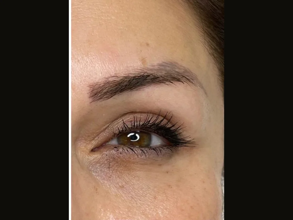 Mis-shaped cosmetic tattoo — before removal, real client