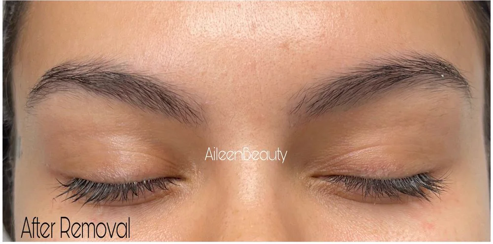 Dark ashy brow tattoo — after non-laser removal, real client
