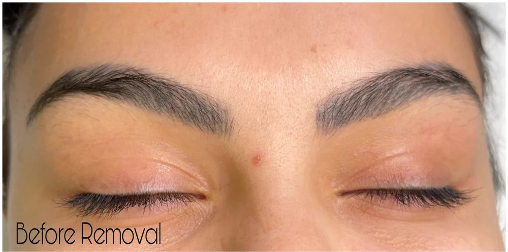 Dark ashy brow tattoo — before removal, real client