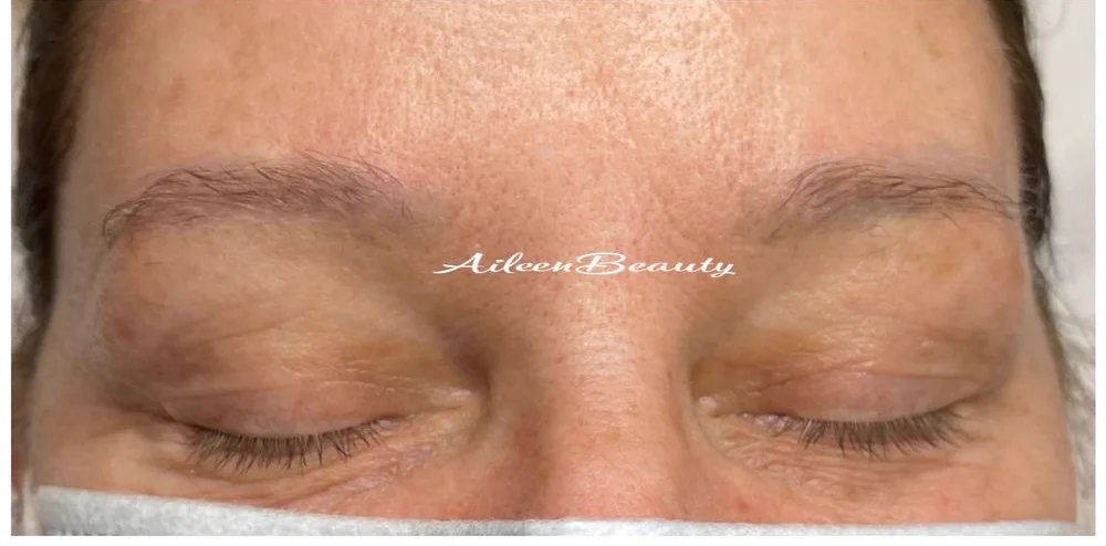 Cool-shifted microblading — after non-laser removal, real client