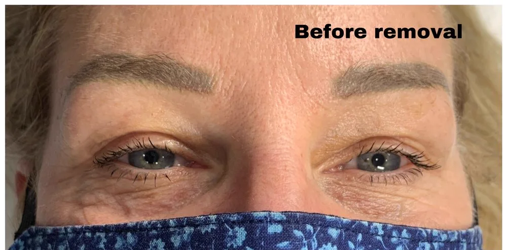 Cool-shifted microblading — before removal, real client