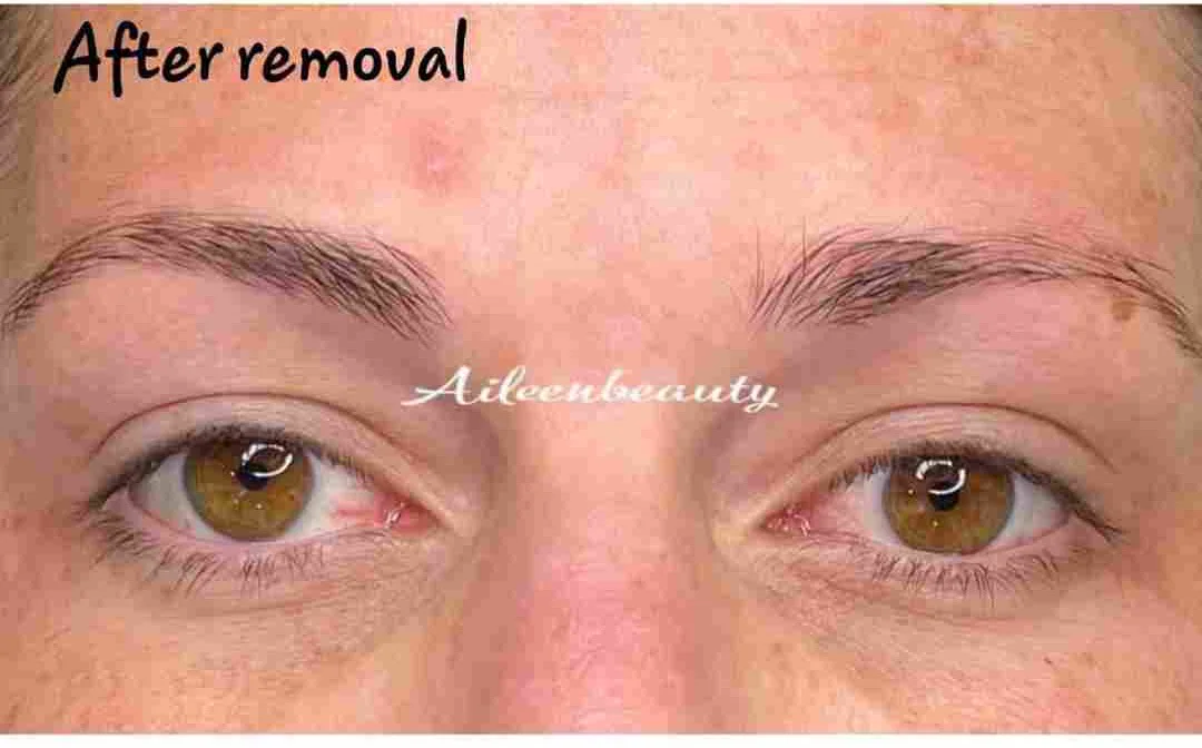 Saturated powder brows — after non-laser removal, real client