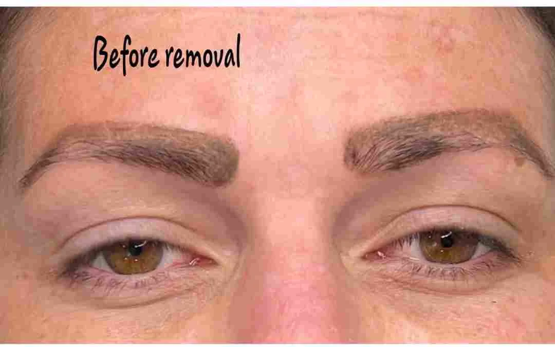 Saturated powder brows — before removal, real client